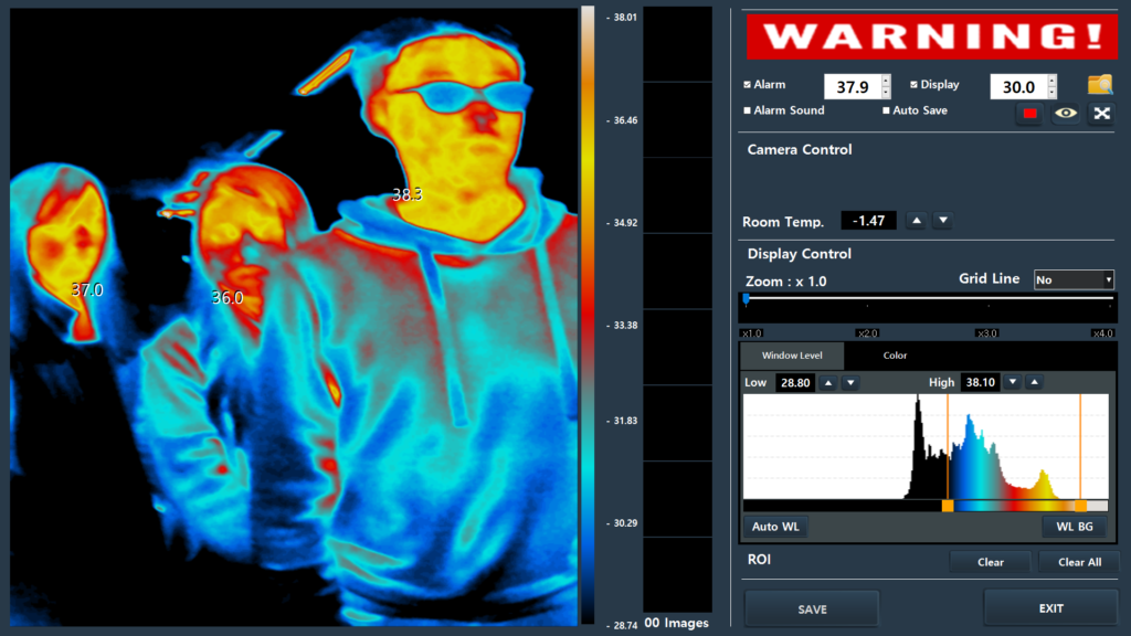 Iris-Q Thermal scanning device